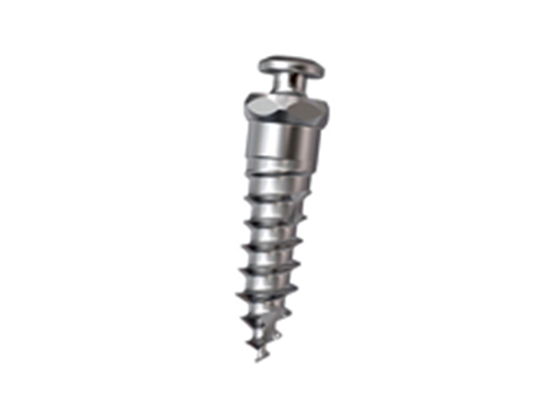 Cabinet d'Orthodontie Blanchard - Les Appareillages - Implants zygomatiques ou minivis